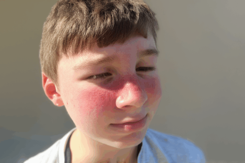 Why Do We Blush? The Surprising Science Behind Red Cheeks!