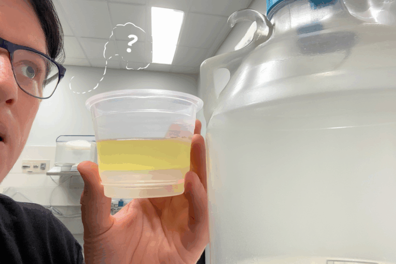 Why 24-Hour Urine Collection is Important (And What It Tells Your Doctor!)